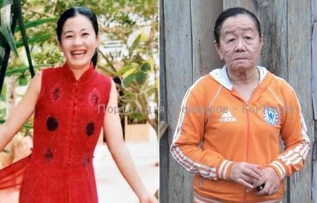 Страшные последствия после аллергии